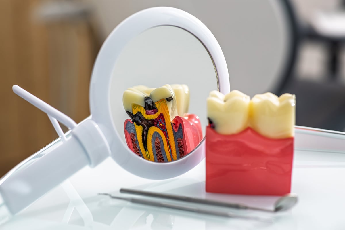 Modelo anatómico dental con capas y herramientas dentales, ilustrando el cuidado dental