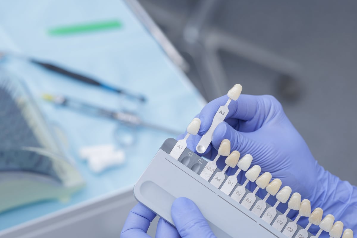 Manos con guantes sosteniendo una guía de color dental para combinar el tono dental