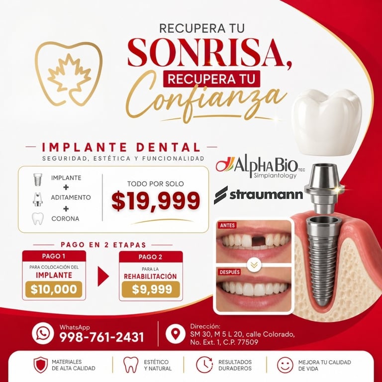 Dental implant promotional flyer advertising tooth restoration procedure with pricing and payment options