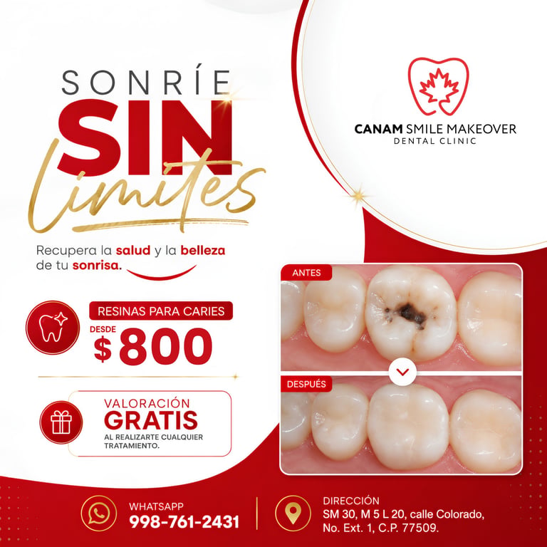 Dental clinic promotional flyer for Sonrié Sin Límites showing before and after cavity treatment results, pricing, and contact information.