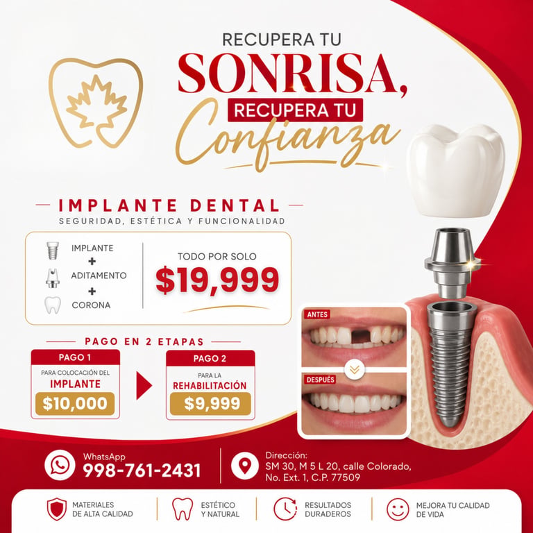 Dental implant promotional flyer advertising tooth restoration with pricing, payment plan, and contact information in Spanish