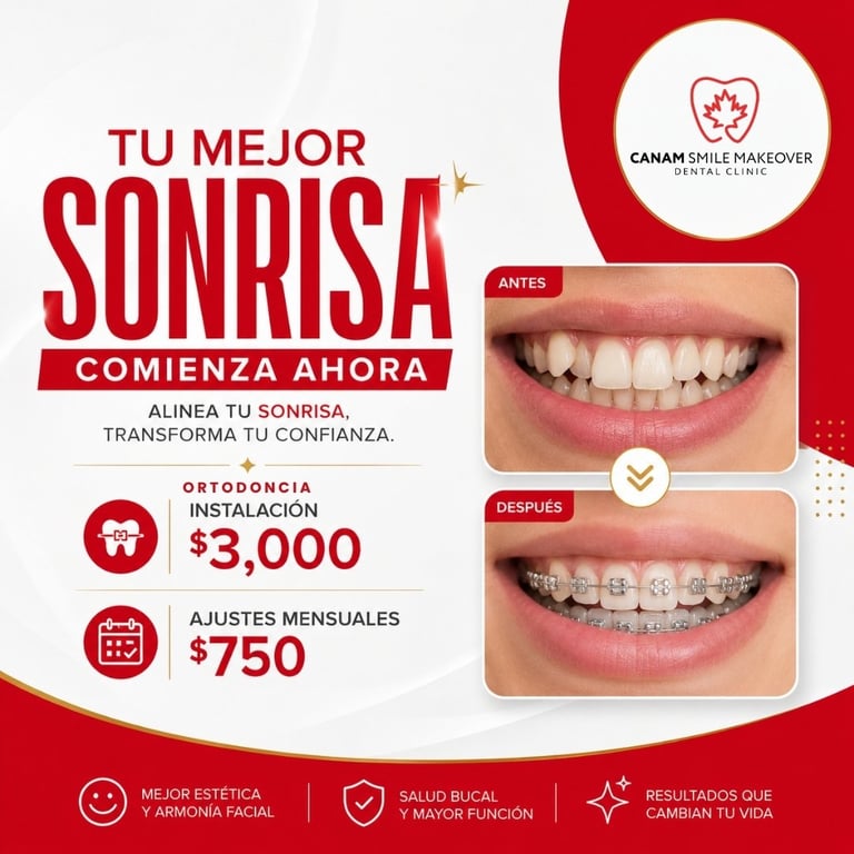 Dental makeover advertisement showing before and after smile comparison with orthodontic prices starting at $3,000 and monthly adjustments at $750