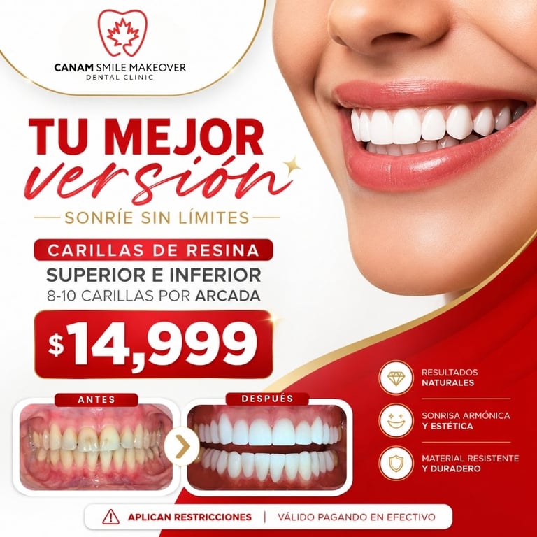 Dental clinic advertisement for tooth veneers priced at $14,999 showing before and after smile results