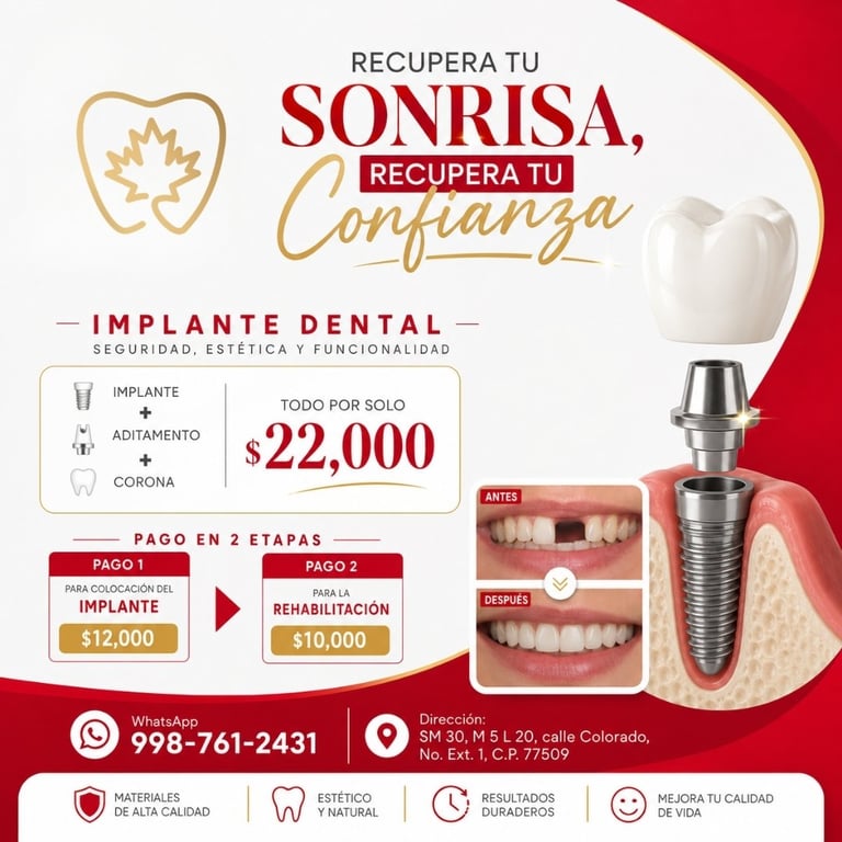 Dental implant promotional poster in Spanish advertising $22,000 for implant, abutment, and crown with payment plan options